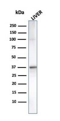 Western Blot: Complement Component C1qA Antibody (C1QA/2955) [NBP3-08748] - Western Blot Analysis of human Liver tissue lysate using Complement Component C1qA Mouse Monoclonal Antibody (C1QA/2955).