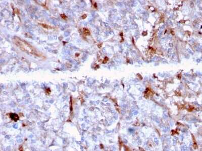 Immunohistochemistry-Paraffin: Complement Component C1qA Antibody (C1QA/2956) [NBP3-08755] - Formalin-fixed, paraffin-embedded human Kidney stained with Complement Component C1qA Mouse Monoclonal Antibody (Complement Component C1qA/2956).