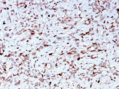 Immunohistochemistry-Paraffin: Complement Component C1qA Antibody (C1QA/2956) [NBP3-08755] - Formalin-fixed, paraffin-embedded human Liver stained with Complement Component C1qA Mouse Monoclonal Antibody (Complement Component C1qA/2956).