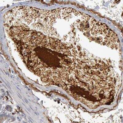 Immunohistochemistry: Complement Component C1qC Antibody [NBP1-89885] - Staining in human small intestine showing distinct positivity in plasma.