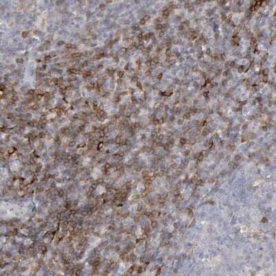 Immunohistochemistry-Paraffin: Complement Component C1qC Antibody [NBP1-89885] - Staining of human lymphoid tissues shows moderate cytoplasmic positivity in non-germinal center cells.