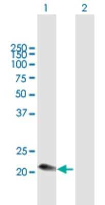 Western Blot: Complement Component C1qC Antibody [H00000714-B01P] - Analysis of C1QC expression in transfected 293T cell line by C1QC polyclonal antibody.  Lane 1: C1QG transfected lysate(26.95 KDa). Lane 2: Non-transfected lysate.