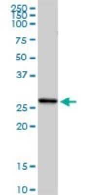 Western Blot: Complement Component C1qC Antibody [H00000714-D01P] - Analysis of C1QC expression in human spleen.