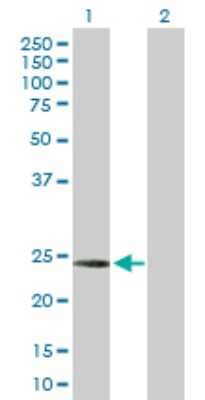 Western Blot: Complement Component C1qC Antibody [H00000714-D01P] - Analysis of C1QC expression in transfected 293T cell line by C1QC polyclonal antibody.Lane 1: C1QC transfected lysate(25.80 KDa).Lane 2: Non-transfected lysate.