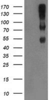 Western Blot: Complement Component C1r Antibody (OTI1F1) - Azide and BSA Free [NBP2-70318] - HEK293T cells were transfected with the pCMV6-ENTRY control (Left lane) or pCMV6-ENTRY C1r (Right lane) cDNA for 48 hrs and lysed. Equivalent amounts of cell lysates (5 ug per lane) were separated by SDS-PAGE and immunoblotted with anti-C1r.