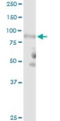 Western Blot: Complement Component C1r Antibody [H00000715-D01P] - Analysis of C1R expression in human kidney.