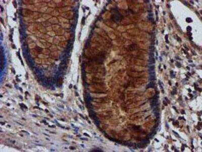 Immunohistochemistry-Paraffin: Complement Component C1s Antibody (4E3) [NBP2-01625] -  Staining of paraffin-embedded Human colon tissue using anti-Complement Component C1s mouse monoclonal antibody.