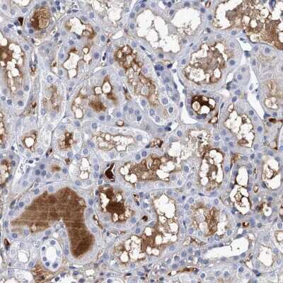Immunohistochemistry: Complement Component C2 Antibody (5C3) - BSA Free [NBP2-23549] - Staining of human kidney shows strong positivity in extracellular material.