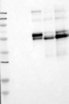 Western Blot: Complement Component C2 Antibody (5C3) - BSA Free [NBP2-23549] - Lane 1: Marker [kDa] 250, 130, 95, 72, 55, 36, 28, 17, 11  Lane 2: RT4  Lane 3: U-251 MG  Lane 4: Human Plasma  Lane 5: Liver  Lane 6: Tonsil