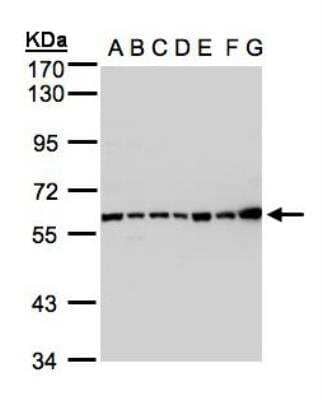 Western Blot: Complement Component C2 Antibody [NBP1-32589] - Complement C2 Antibody [NBP1-32589] - Sample(30 ug whole cell lysate) A: 293T B: A431 C: H1299 D: HeLa S3 E: Hep G2 F: MOLT4 G: Raji 7.5% SDS PAGE, antibody diluted at 1:1000.