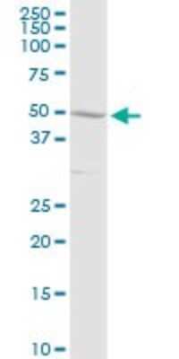 Western Blot: Complement Component C3a R Antibody [H00000719-D01P] - Analysis of C3AR1 expression in human liver.