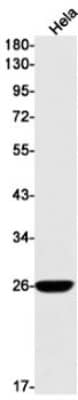 Western Blot: Complement Factor D/Adipsin Antibody (S09-6A9) [NBP3-19629] - Western blot detection of Complement Factor D/Adipsin in Hela cell lysates using NBP3-19629 (1:1000 diluted). Predicted band size: 27kDa. Observed band size: 27kDa.