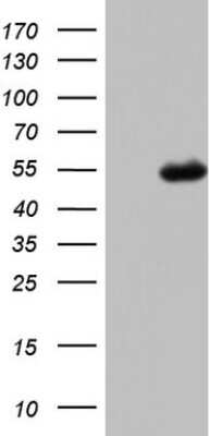 Western Blot: Complement Factor H Antibody (5H5) [NBP2-46263] - Analysis of HEK293T cells were transfected with the pCMV6-ENTRY control (Left lane) or pCMV6-ENTRY Complement factor H.