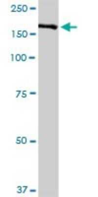 Western Blot: Complement Factor H Antibody [H00003075-D01P] - Analysis of CFH expression in human kidney.