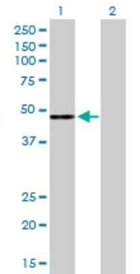Western Blot: Complement Factor H Antibody [H00003075-D01P] - Analysis of CFH expression in transfected 293T cell line by CFH polyclonal antibody.Lane 1: CFH transfected lysate(51.00 KDa).Lane 2: Non-transfected lysate.