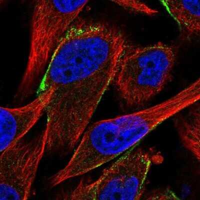 Immunocytochemistry/Immunofluorescence: Complement Factor H-related 1/CFHR1/CFHL1 Antibody [NBP2-14474] - Staining of human cell line U-251 MG shows localization to vesicles.