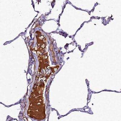 Immunohistochemistry: Complement Factor H-related 1/CFHR1/CFHL1 Antibody [NBP2-14475] - Staining of human lung shows distinct positivity in plasma.