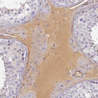 Immunohistochemistry-Paraffin: Complement Factor H-related 1/CFHR1/CFHL1 Antibody [NBP2-14474] - Staining of human testis shows moderate extracellular space positivity in Leydig cells.