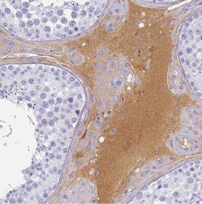 Immunohistochemistry-Paraffin: Complement Factor H-related 1/CFHR1/CFHL1 Antibody [NBP2-54683] - Staining of human testis shows positivity in plasma.