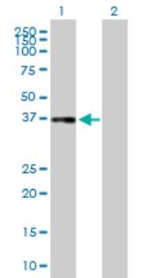 Western Blot: Complement Factor H-related 1/CFHR1/CFHL1 Antibody [H00003078-B01P] - Analysis of CFHR1 expression in transfected 293T cell line by CFHR1 polyclonal antibody.  Lane 1: CFHL1 transfected lysate(36.41 KDa). Lane 2: Non-transfected lysate.