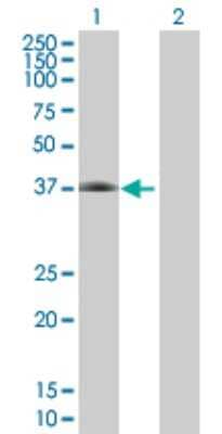 Western Blot: Complement Factor H-related 1/CFHR1/CFHL1 Antibody [H00003078-B02P] - Analysis of CFHR1 expression in transfected 293T cell line by CFHR1 polyclonal antibody.  Lane 1: CFHL1 transfected lysate(36.3 KDa). Lane 2: Non-transfected lysate.