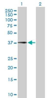 Western Blot: Complement Factor H-related 1/CFHR1/CFHL1 Antibody [H00003078-D01P] - Analysis of CFHR1 expression in transfected 293T cell line by CFHR1 polyclonal antibody.Lane 1: CFHR1 transfected lysate(37.70 KDa).Lane 2: Non-transfected lysate.