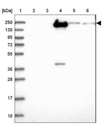 Western Blot: Complement Factor H-related 1/CFHR1/CFHL1 Antibody [NBP2-14474] - Lane 1: Marker  [kDa] 250, 130, 95, 72, 55, 36, 28, 17, 10.  Lane 2: Human cell line RT-4.  Lane 3: Human cell line U-251MG sp.  Lane 4: Human plasma (IgG/HSA depleted).  Lane 5: Human liver tissue.  Lane 6: Human tonsil tissue