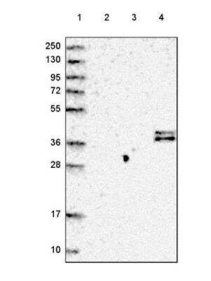 Western Blot: Complement Factor H-related 1/CFHR1/CFHL1 Antibody [NBP2-54683] - Lane 1: Marker [kDa] 250, 130, 95, 72, 55, 36, 28, 17, 10 Lane 2: Human cell line RT-4 Lane 3: Human cell line U-251 MG Lane 4: Human plasma