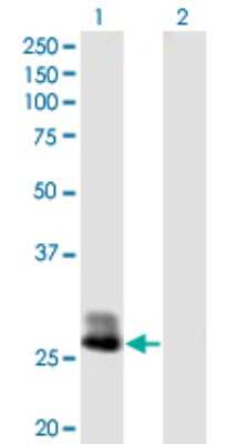 Western Blot: Complement Factor H-related 2/CFHR2/CFHL2 Antibody [H00003080-B02P] - Analysis of CFHR2 expression in transfected 293T cell line by CFHR2 polyclonal antibody.  Lane 1: CFHL2 transfected lysate(29.7 KDa). Lane 2: Non-transfected lysate.