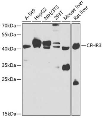 Western Blot Complement Factor H-related 3/CFHR3 Antibody - BSA Free