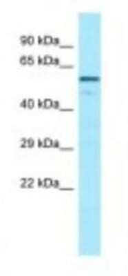 Western Blot: Complement Factor H-related 4/CFHR4 Antibody [NBP1-98532] - Placenta Lysate 1.0ug/ml, Gel Concentration: 12%