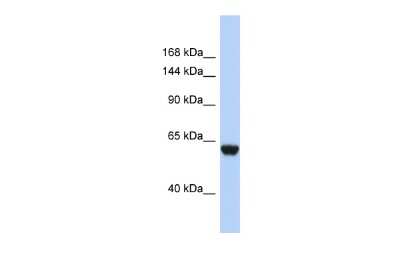 Western Blot: Complement Factor H-related 4/CFHR4 Antibody [NBP3-10545] - Western blot analysis of Complement Factor H-related 4/CFHR4 in 721_B Whole Cell lysates. Antibody dilution at 1.0ug/ml