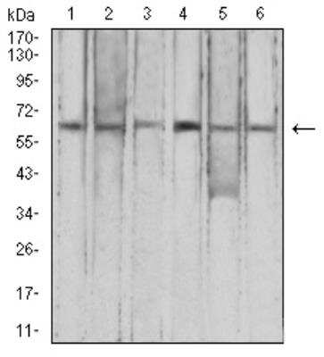 Western Blot: Complement Factor H-related 5/CFHR5 Antibody (3A10A5) [NBP2-52441] - Analysis using CFHR5 mouse mAb against HepG2 (1), K562 (2), L-02 (3), SK-Hep-1 (4), SMMC-7721 (5), and NIH/3T3 (6) cell lysate.