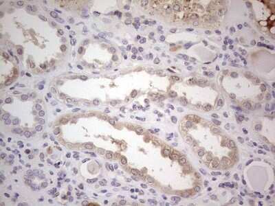 Immunohistochemistry: Complement Factor I Antibody (OTI7C9) - Azide and BSA Free [NBP2-70997] - Analysis of Human Kidney tissue, dilution 1:150