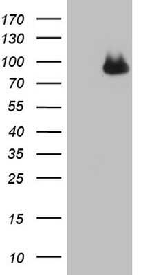 Western Blot: Complement Factor I Antibody (OTI7C9) - Azide and BSA Free [NBP2-70997] - Analysis of HEK293T cells were transfected with the pCMV6-ENTRY control (Left lane) or pCMV6-ENTRY Complement Factor 1.