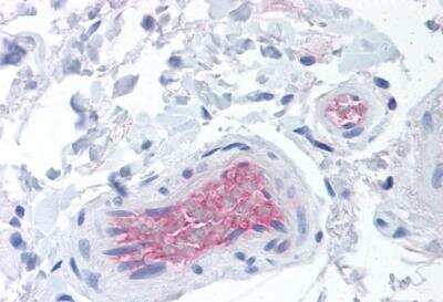 Immunohistochemistry-Paraffin: Complement Factor I Antibody (OX-21) [NBP1-02915] - Human colon, vessels tissue after heat-induced antigen retrieval. Antibody concentration 20 ug/ml.