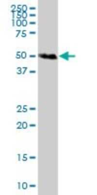 Western Blot: Complement Factor I Antibody [H00003426-B01P] - Analysis of IF expression in human kidney.