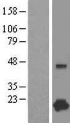 Western Blot: Complexin-1 Overexpression Lysate (Adult Normal) [NBL1-09435] Left-Empty vector transfected control cell lysate (HEK293 cell lysate); Right -Over-expression Lysate for Complexin-1.