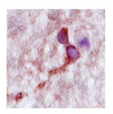 Immunohistochemistry-Paraffin: Complexin-2 Antibody [NBP1-57001] - Human Hippocampus Tissue detected using HRP/AEC red color stain.