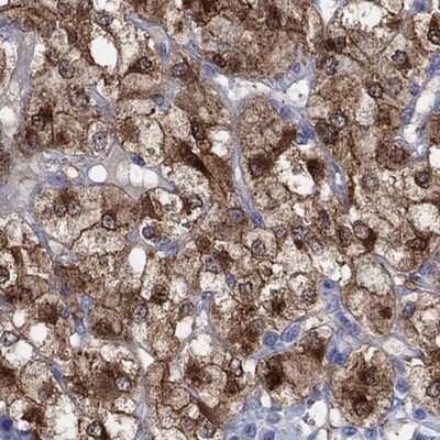 Immunohistochemistry-Paraffin: Complexin-2 Antibody [NBP3-17821] - Staining of human adrenal gland shows strong positivity in adrenal medulla.