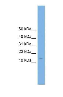 Western Blot: Complexin-2 Antibody [NBP1-57001] - WB Suggested Anti-CPLX2 Antibody Titration: 0.2-1 ug/ml Positive Control: Human Liver