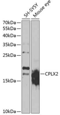 Western Blot: Complexin-2 Antibody [NBP2-92514] - Analysis of extracts of various cell lines, using Complexin-2 .Exposure time: 30s.