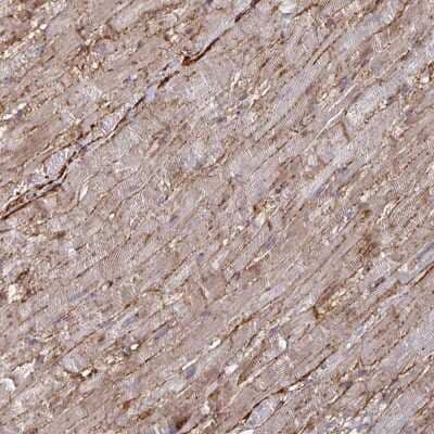 Immunohistochemistry: Connexin 37/GJA4 Antibody [NBP2-48886] - Staining of human heart muscle shows moderate membranous and cytoplasmic positivity in myocytes.
