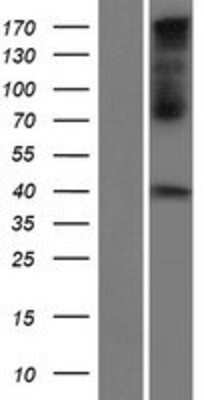 Western Blot: Connexin 40.1 Overexpression Lysate (Adult Normal) [NBP2-05261] Left-Empty vector transfected control cell lysate (HEK293 cell lysate); Right -Over-expression Lysate for Connexin 40.1.
