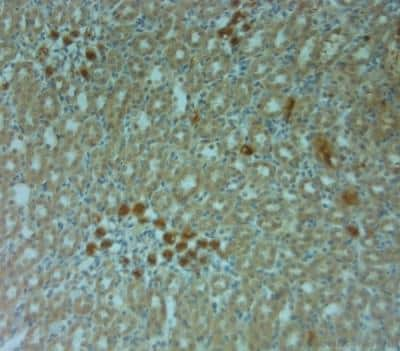 Immunohistochemistry-Paraffin: Connexin 40/GJA5 Antibody [NBP1-46568] - IHC on paraffin sections of rat kidney tissue using Rabbit antibody to Connexin 40. HIER: 1 mM EDTA, pH 8 for 20 min. Blocking: 0.2% LFDM in TBST filtered thru 0.2 um. Detection was done using Novolink HRP polymer from Leica following manufactures instructions. Primary antibody: dilution 1: 1000, incubated 30 min at RT (using Autostainer. Sections were counterstained with Harris Hematoxylin.