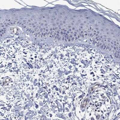 Immunohistochemistry-Paraffin: Connexin 40/GJA5 Antibody [NBP3-17079] - Staining of human skin shows low expression as expected.