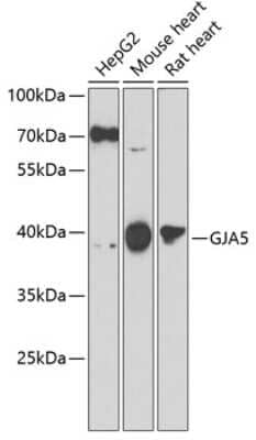 Western Blot: Connexin 40/GJA5 Antibody [NBP2-92491] - Analysis of extracts of various cell lines, using Connexin 40/GJA5 .Exposure time: 60s.