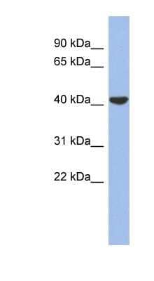 Western Blot: Connexin 40.1 Antibody [NBP1-59280] - PANC1 cell lysate, concentration 0.2-1 ug/ml.