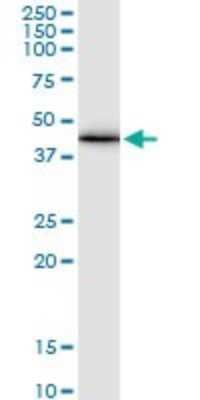 Western Blot: Connexin 43/GJA1 Antibody (3E5) [H00002697-M01] - GJA1 monoclonal antibody (M01), clone 3E5. Analysis of GJA1 expression in human placenta.