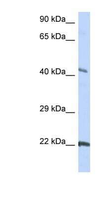 Western Blot: Connexin-45 Antibody [NBP1-59282] - HepG2 cell lysate, concentration 0.2-1 ug/ml.